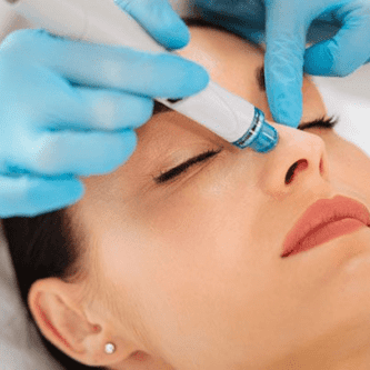 Image for HYDRAFACIAL: EVERYTHING YOU NEED TO KNOW