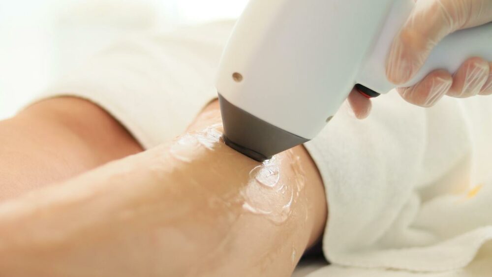 Image for 5 Important Things You Need to Know About Permanent Laser Hair Removal