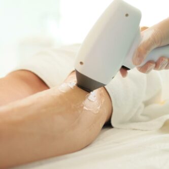 Image for 5 Important Things You Need to Know About Permanent Laser Hair Removal